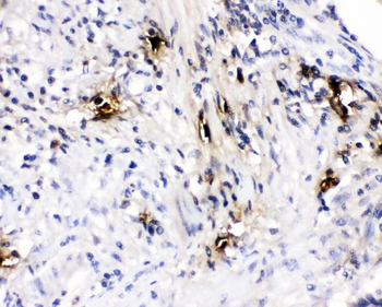 Mast Cell Tryptase/TPSAB1 Rabbit Polyclonal Antibody