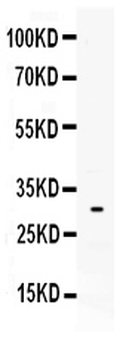 Mast Cell Tryptase/TPSAB1 Rabbit Polyclonal Antibody
