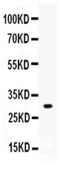ZWINT Rabbit Polyclonal Antibody