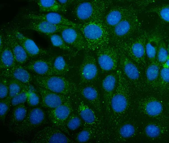 ABAT Rabbit Polyclonal Antibody
