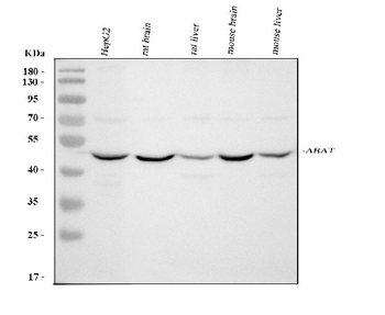 ABAT Rabbit Polyclonal Antibody