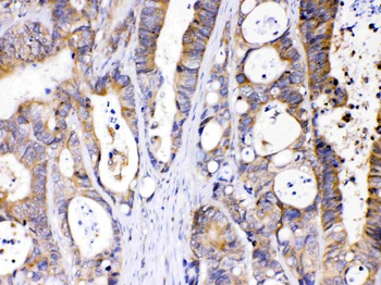 Abhd5 Rabbit Polyclonal Antibody