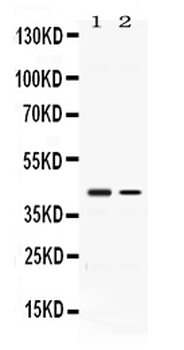 Abhd5 Rabbit Polyclonal Antibody