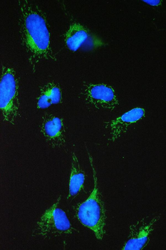 ACAA2 Rabbit Polyclonal Antibody