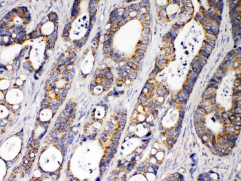 ACAA2 Rabbit Polyclonal Antibody
