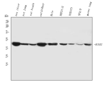ACAA2 Rabbit Polyclonal Antibody
