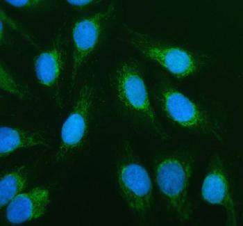 ACADVL Rabbit Polyclonal Antibody