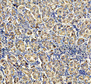 ACADVL Rabbit Polyclonal Antibody