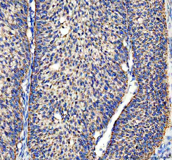 ACADVL Rabbit Polyclonal Antibody