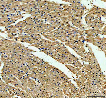 ACADVL Rabbit Polyclonal Antibody