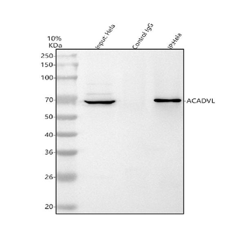 ACADVL Rabbit Polyclonal Antibody