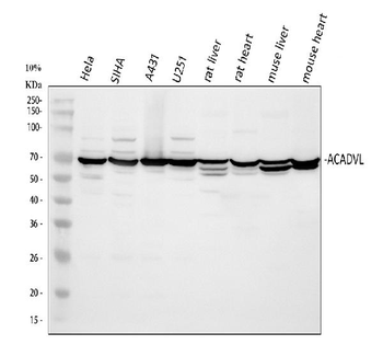 ACADVL Rabbit Polyclonal Antibody