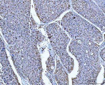 ATP citrate lyase/ACLY Antibody