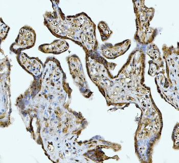 ATP citrate lyase/ACLY Antibody