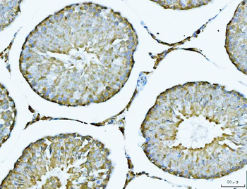 ATP citrate lyase/ACLY Antibody