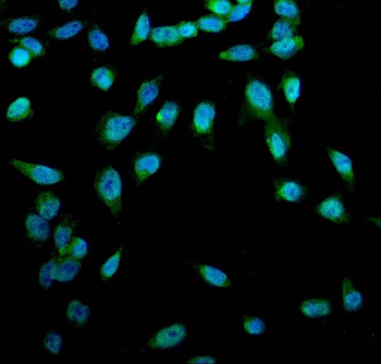 ACSL1 Rabbit Polyclonal Antibody