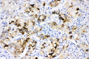 ACSL1 Rabbit Polyclonal Antibody