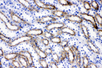 ACSL1 Rabbit Polyclonal Antibody
