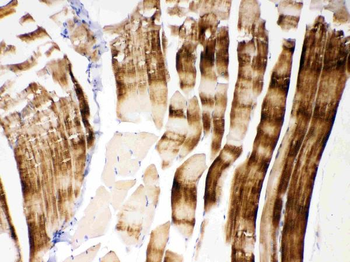 ACTN3 Rabbit Polyclonal Antibody
