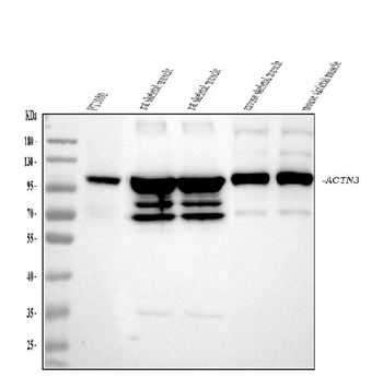 ACTN3 Rabbit Polyclonal Antibody