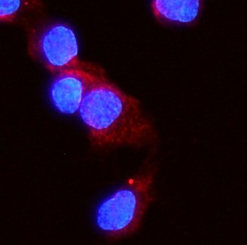 Activin Receptor Type IIA/ACVR2A Antibody