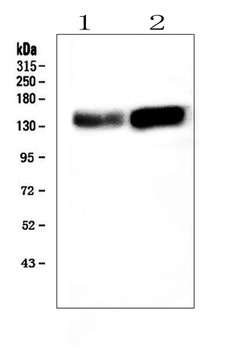 ADAMTS13 Rabbit Polyclonal Antibody