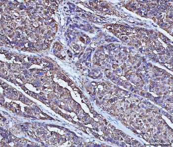 Alcohol Dehydrogenase/ADH1A Rabbit Polyclonal Antibody