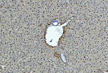 Alcohol Dehydrogenase/ADH1A Rabbit Polyclonal Antibody