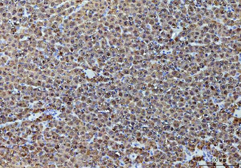 Alcohol Dehydrogenase/ADH1A Rabbit Polyclonal Antibody