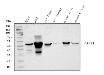 Alcohol Dehydrogenase/ADH1A Rabbit Polyclonal Antibody
