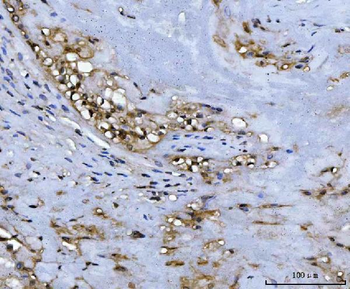 ADK Rabbit Polyclonal Antibody