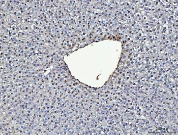 ADK Rabbit Polyclonal Antibody