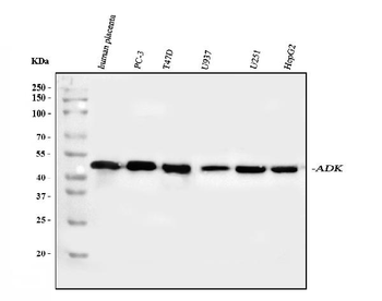 ADK Rabbit Polyclonal Antibody