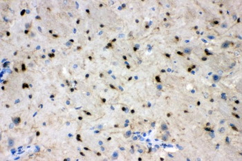 ADO Rabbit Polyclonal Antibody