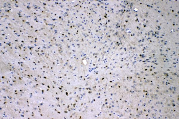 ADO Rabbit Polyclonal Antibody