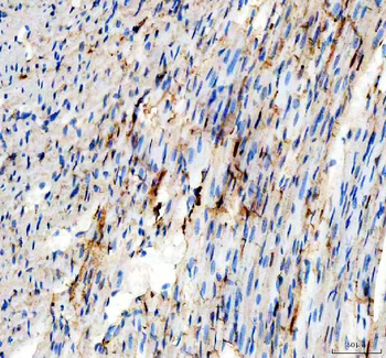 Adenylate Kinase 1/AK1 Antibody