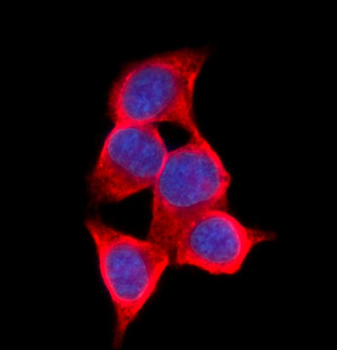 AKR1C1/C2 Rabbit Polyclonal Antibody