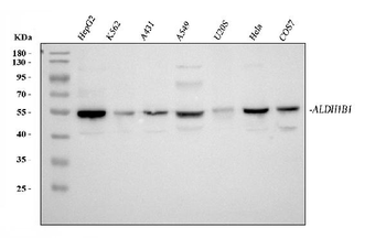 ALDH1B1 Rabbit Polyclonal Antibody