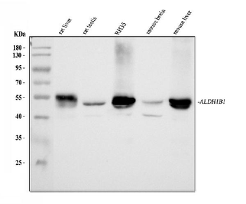 ALDH1B1 Rabbit Polyclonal Antibody