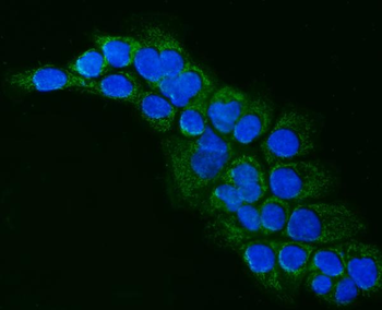 ALDH1B1 Rabbit Polyclonal Antibody