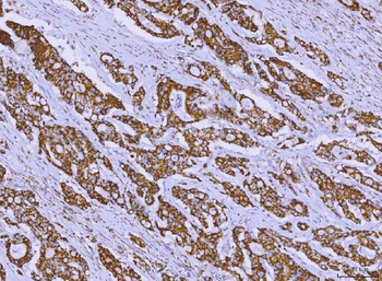 ALDH1B1 Rabbit Polyclonal Antibody