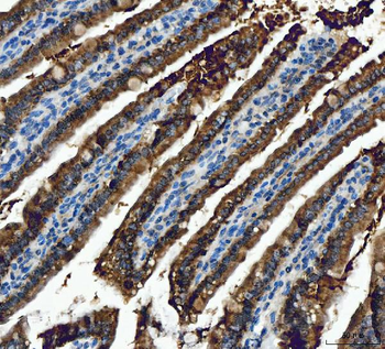 ALDH1B1 Rabbit Polyclonal Antibody