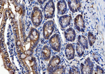 ALDH1B1 Rabbit Polyclonal Antibody
