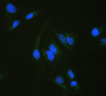 ALDH7A1 Rabbit Polyclonal Antibody