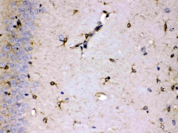 ALDH7A1 Rabbit Polyclonal Antibody