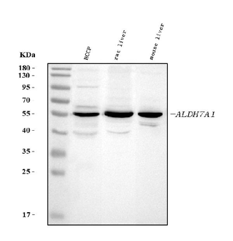 ALDH7A1 Rabbit Polyclonal Antibody