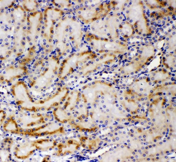 AMFR Rabbit Polyclonal Antibody