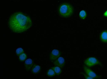 ABP1/AOC1 Rabbit Polyclonal Antibody