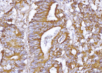 ABP1/AOC1 Rabbit Polyclonal Antibody