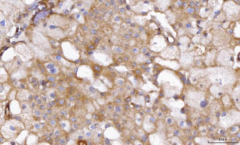 ABP1/AOC1 Rabbit Polyclonal Antibody